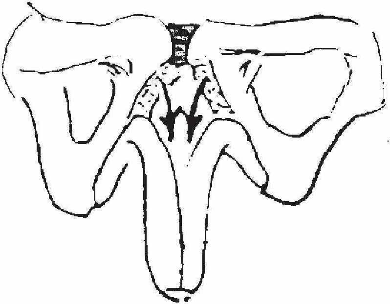 第一節(jié) 陰莖延長術(shù)的發(fā)展史